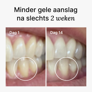 D2 Pro Elektrische Tandenborstel
